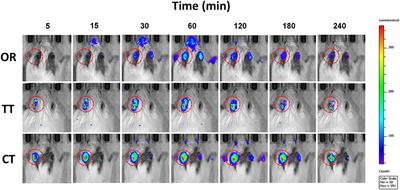 Comparison of Drug Availability in the Inner Ear After Oral, Transtympanic, and Combined Administration